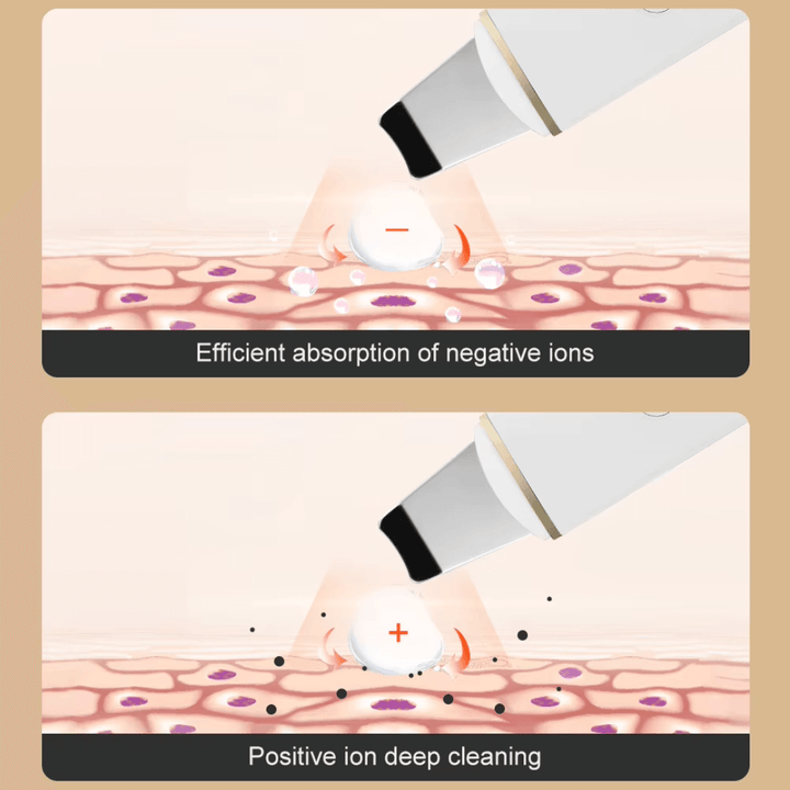 Ultraschall Hautreiniger Porenreiniger Mitesserentferner