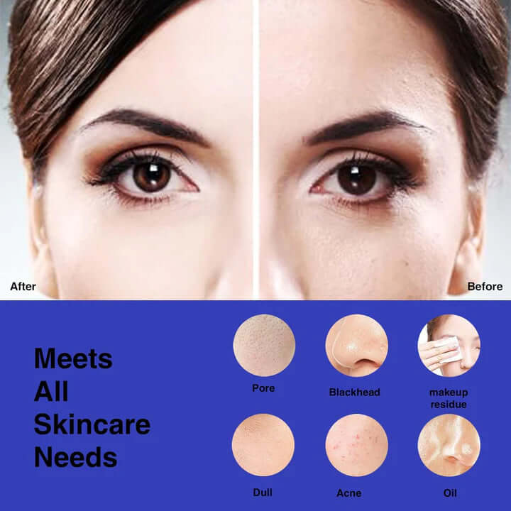 Gesichtsreinigungsbürste - Wasserdicht & Wiederaufladbar