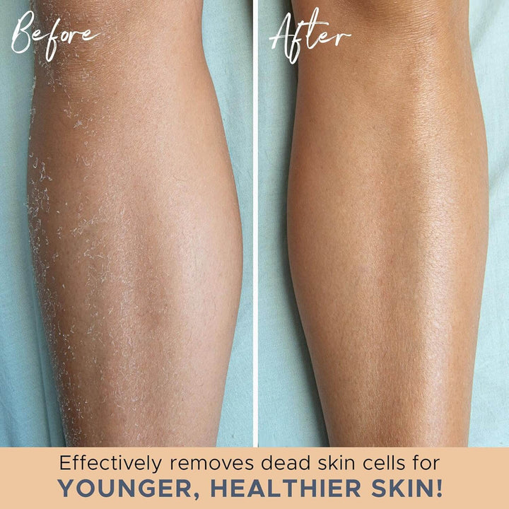 2x Peelinghandschuhe - Für samtweiche Haut