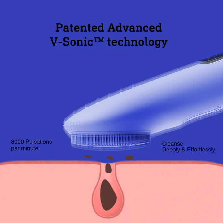 Gesichtsreinigungsbürste - Wasserdicht & Wiederaufladbar