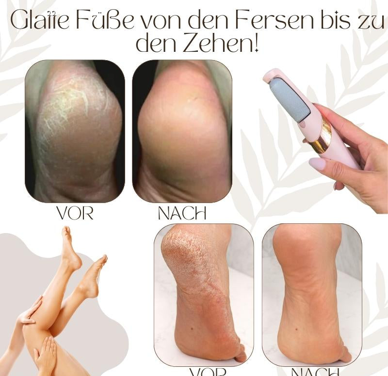 Elektrischer Hornhautentferner mit LED-Licht, ergonomischem Design, wasserdicht; perfekt für glatte Füße und einfache Handhab