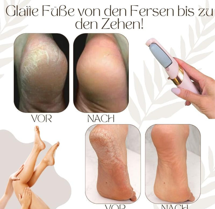 Elektrischer Hornhautentferner mit LED-Licht, ergonomischem Design, wasserdicht; perfekt für glatte Füße und einfache Handhab