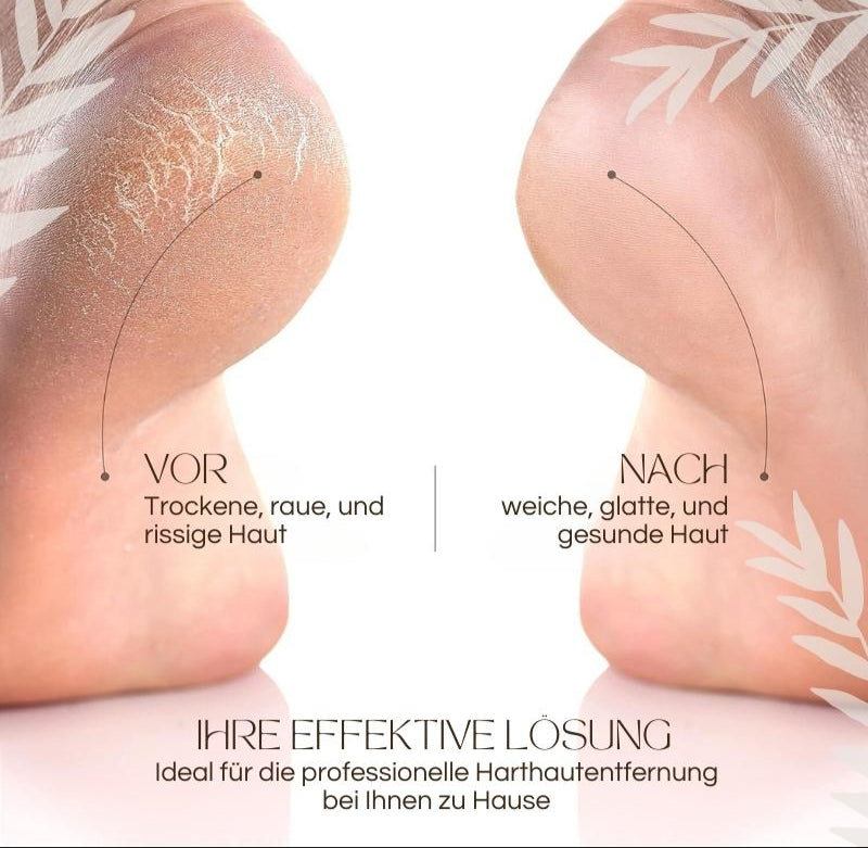 Elektrischer Hornhautentferner mit LED-Licht, ergonomischem Design, wasserdicht; perfekt für glatte Füße und einfache Handhab