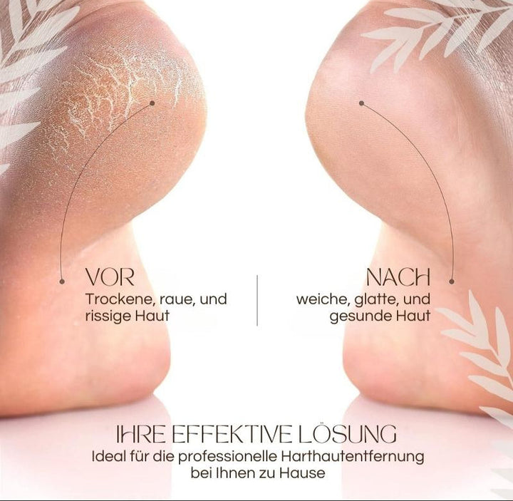 Elektrischer Hornhautentferner mit LED-Licht, ergonomischem Design, wasserdicht; perfekt für glatte Füße und einfache Handhab
