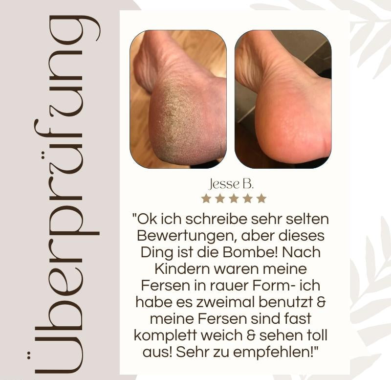 Elektrischer Hornhautentferner mit LED-Licht, ergonomischem Design, wasserdicht; perfekt für glatte Füße und einfache Handhab