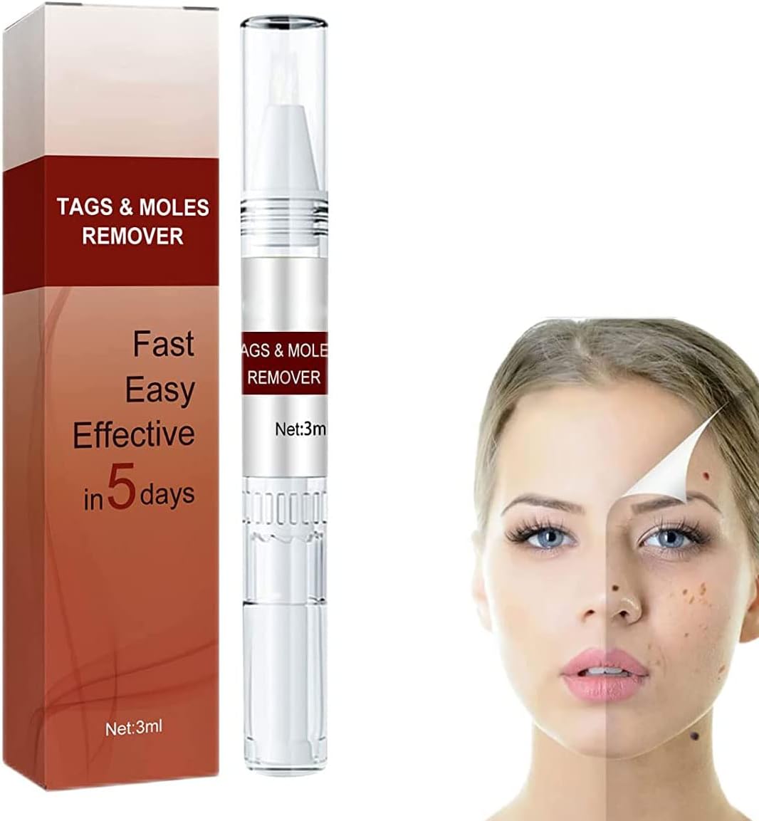 "Hautfleckenentferner mit natürlicher Formel in Pumpflasche, ideal für zu Hause, schnelle Ergebnisse, invasionsfreie Anwendun