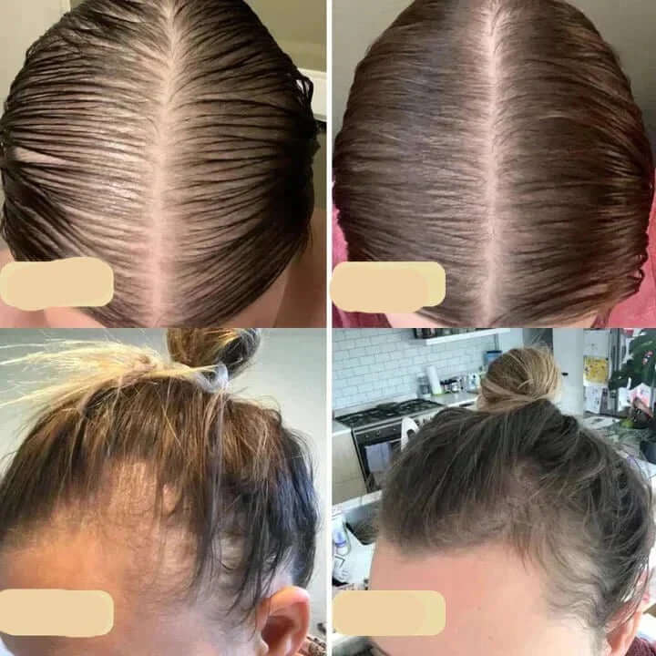 Natürliches Haarwuchsöl für kräftiges Haar