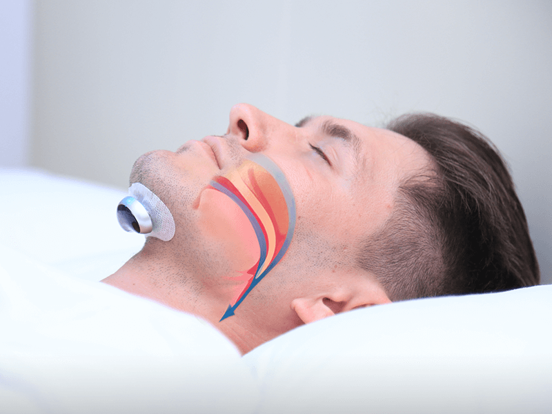 Dispositif anti-ronflement pour des nuits tranquilles