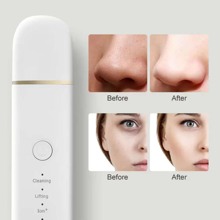 Gesichtsreinigungsgerät für Tiefenreinigung & Lifting