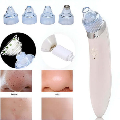 2-in-1 Gesichtsreiniger & Mikrodermabrasionsgerät