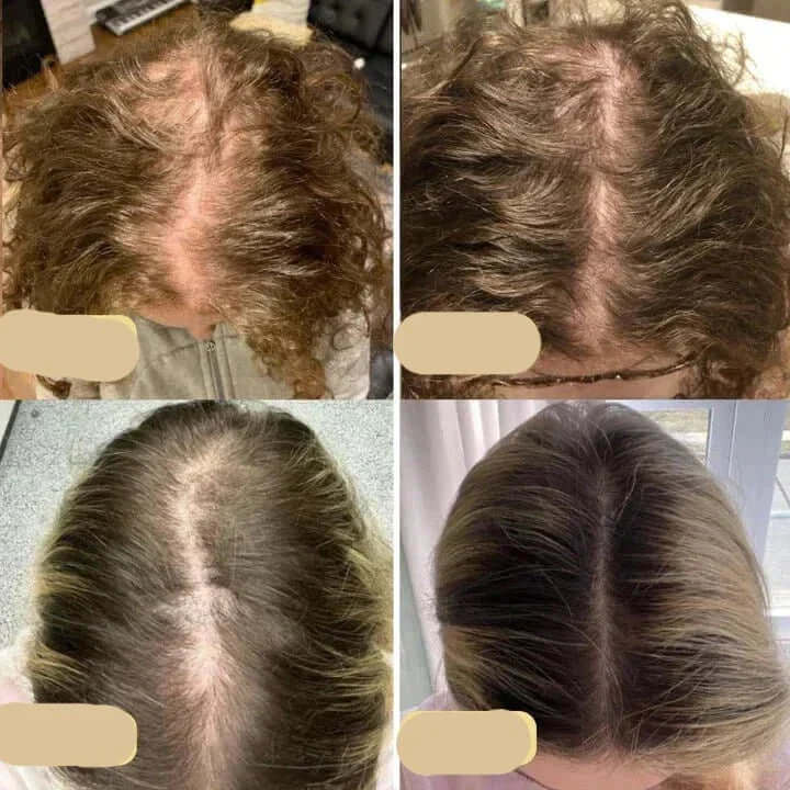 Natürliches Haarwuchsöl für kräftiges Haar