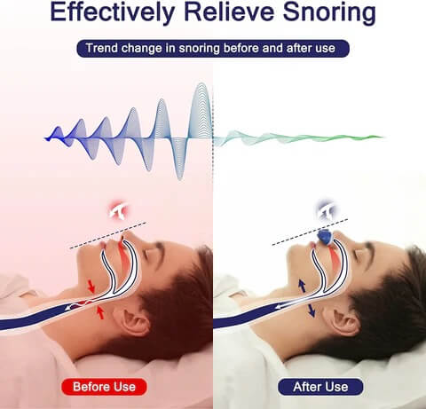 Micro CPAP Schlafapnoe-Gerät