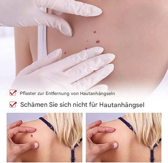 "Hautfleckenentferner mit natürlicher Formel in Pumpflasche, ideal für zu Hause, schnelle Ergebnisse, invasionsfreie Anwendun
