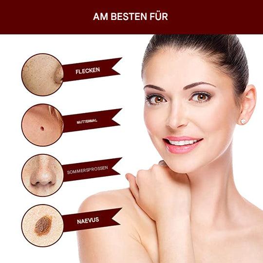 "Hautfleckenentferner mit natürlicher Formel in Pumpflasche, ideal für zu Hause, schnelle Ergebnisse, invasionsfreie Anwendun